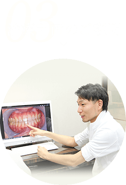治療計画のご説明